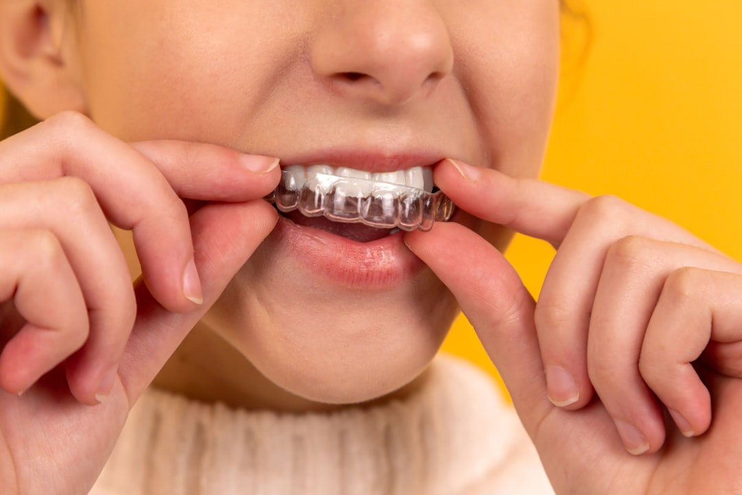 Sorriso alinhado com alinhadores invisíveis em São Luís para tratamento ortodôntico moderno e discreto.